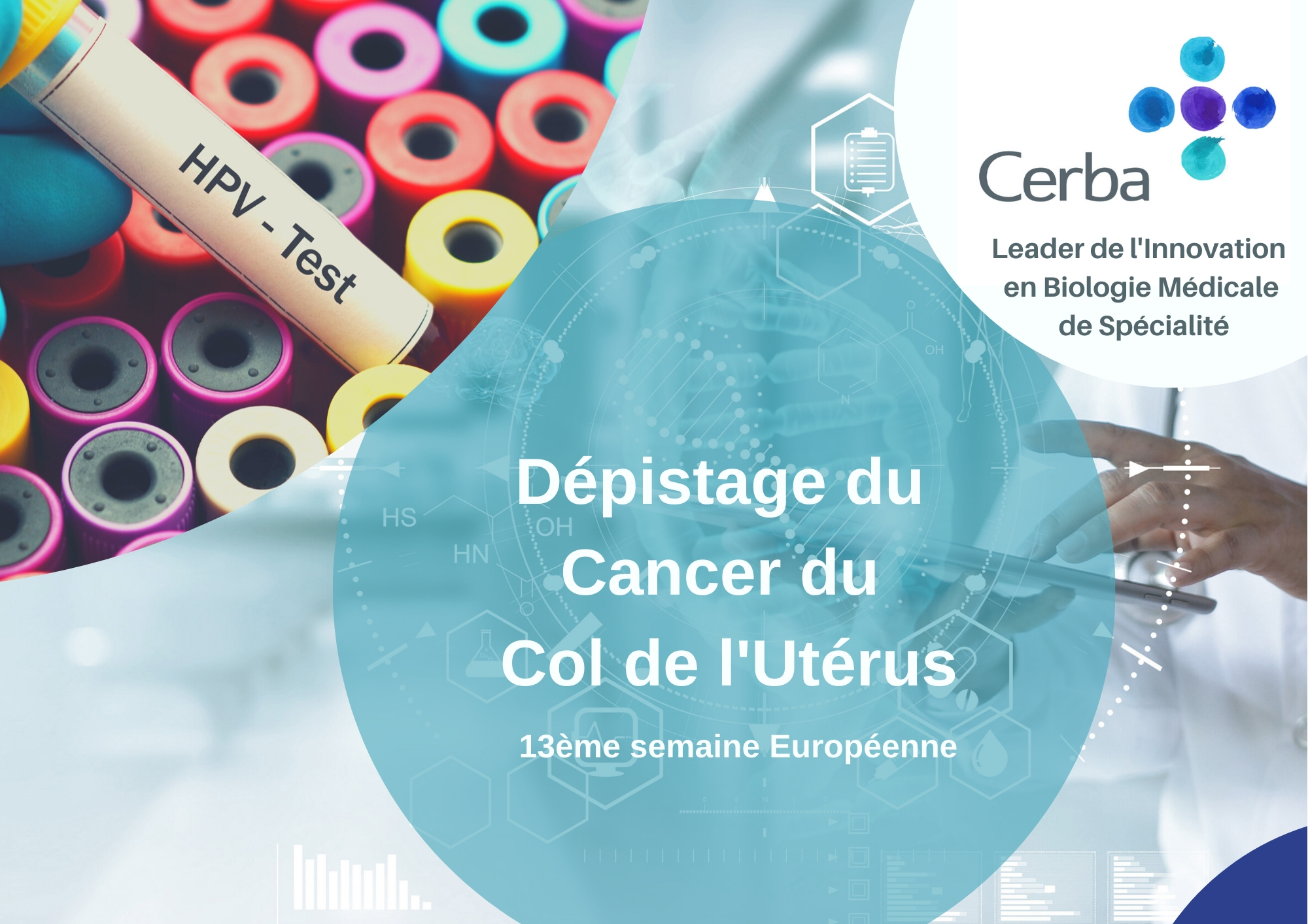 Cancer de l'uterus.jpg