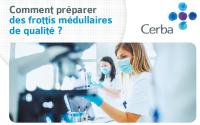 vignette_myelogramme_prepa-resize200x125.jpg